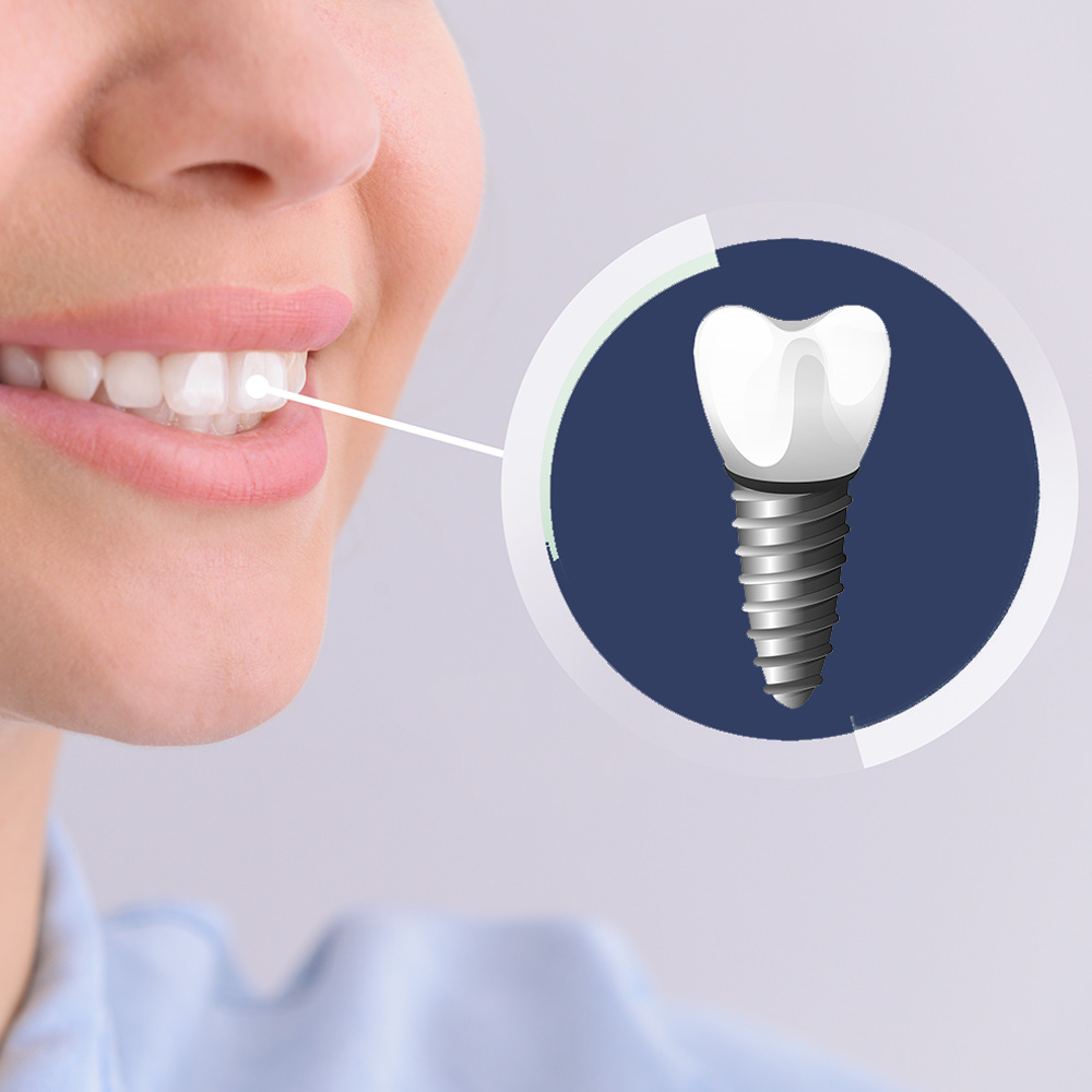 An image featuring a smiling person with a tooth being repaired by a screw, set against a blue background with a magnifying glass icon.